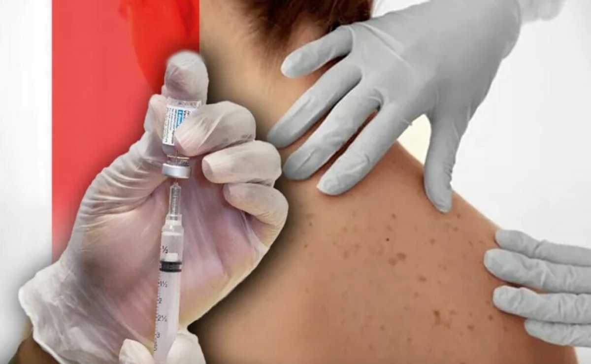 La vacuna experimental contra el cáncer de piel que elaboró la farmacéutica Moderna podría estar disponible en tan solo dos años. Foto: AFP